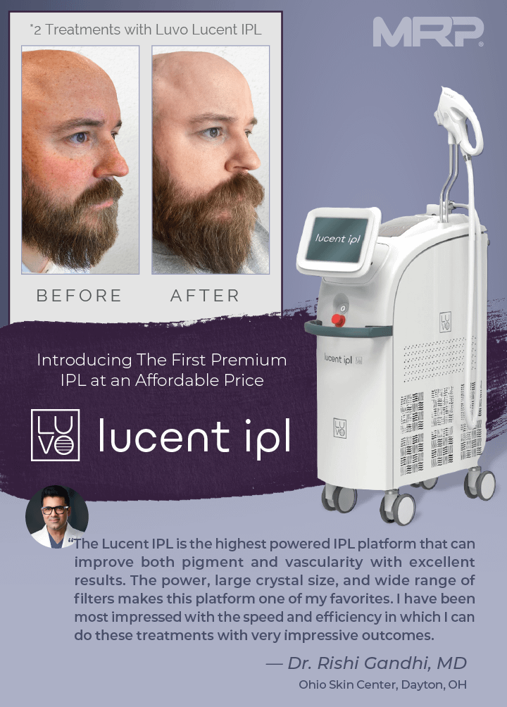 Cynosure DEKA MonaLisa Touch SmartXide2 CO2 Laser Smart Xide II Mona Lisa 2