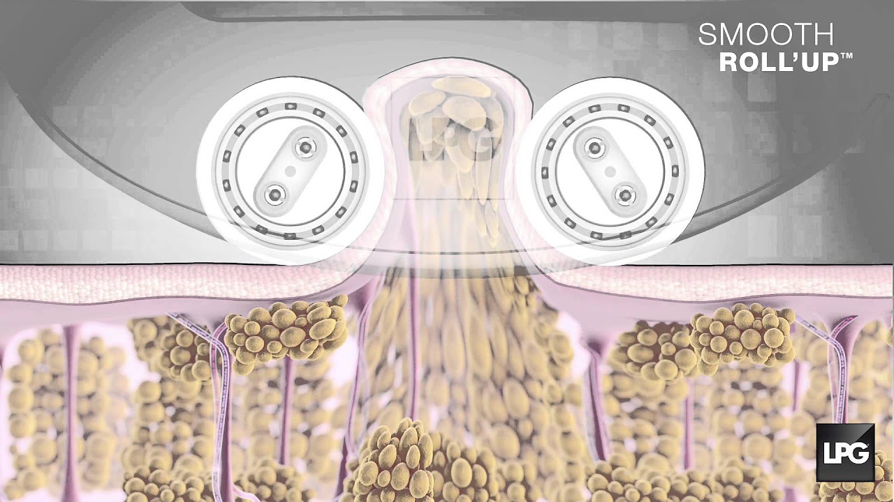 new LIPOMASSAGE Cellu M6 Integral
